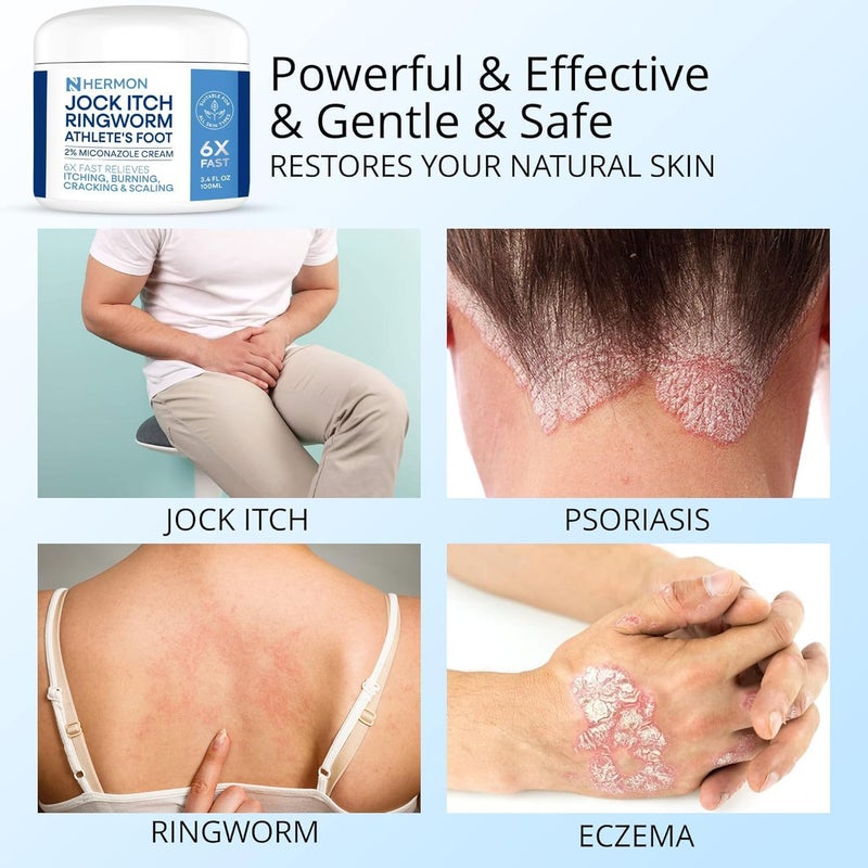 Hermon Jock Itch Antifungal Cream & Spray Set: Ringworm Treatment for Humans, Psoriasis Treatment, Psoriasis Scalp Treatment, Ringworm Cream for Humans, Foot & Body Balm, Provides Soothing Relief - Image 2